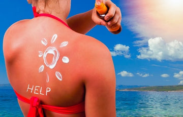 Best Sunburn Remedies